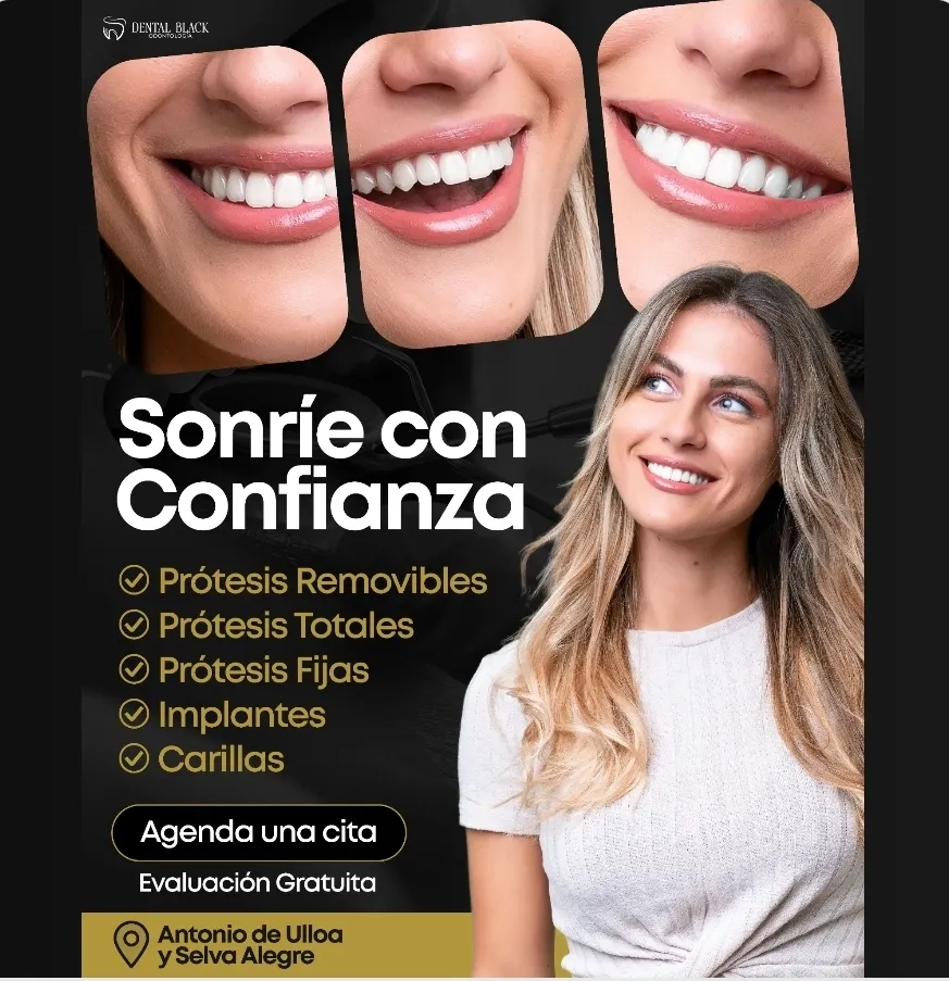 Pieza promocional Sonríe con Confianza de Dental Black con prótesis, implantes y carillas